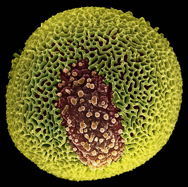 pollen06 Пыльца под микроскопом