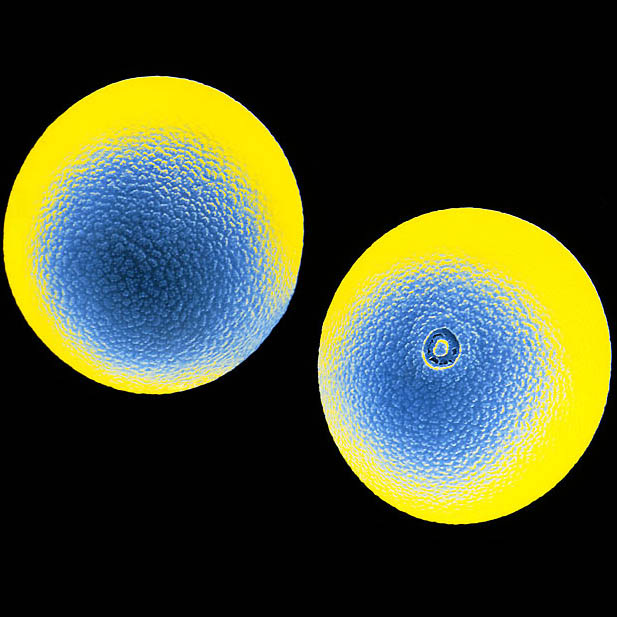 pollen15 Пыльца под микроскопом