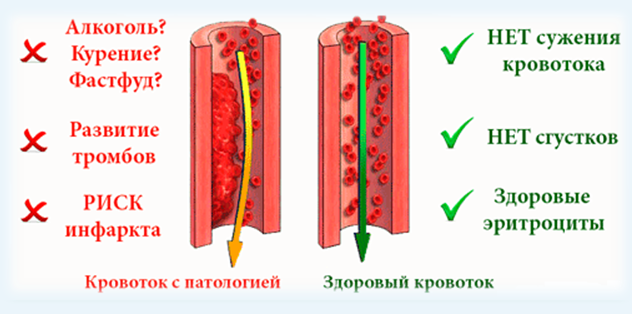 Опасность густой крови