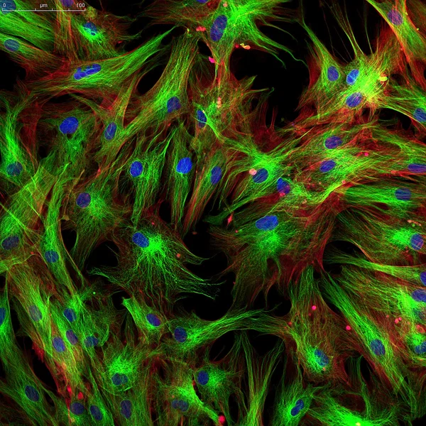 Фибробласты (клетки кожи) обозначены флуоресцентными красителями Стоковое Фото