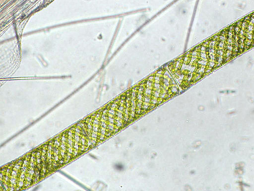 Spirogyra sp